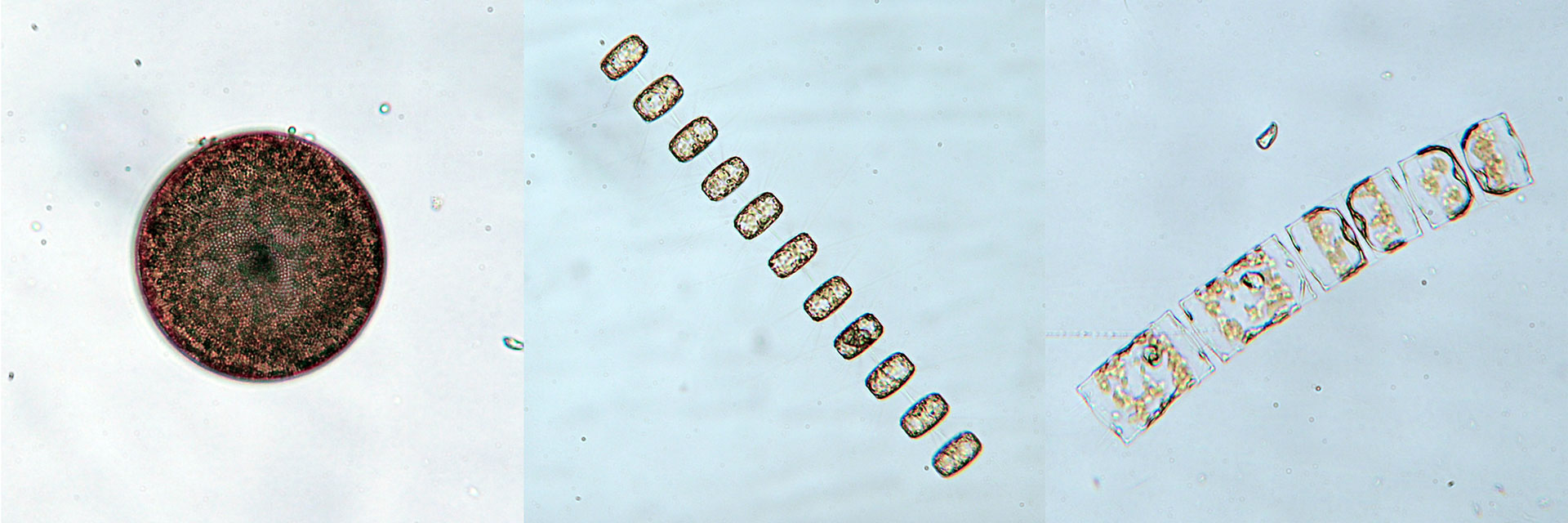 Antartic diatoms